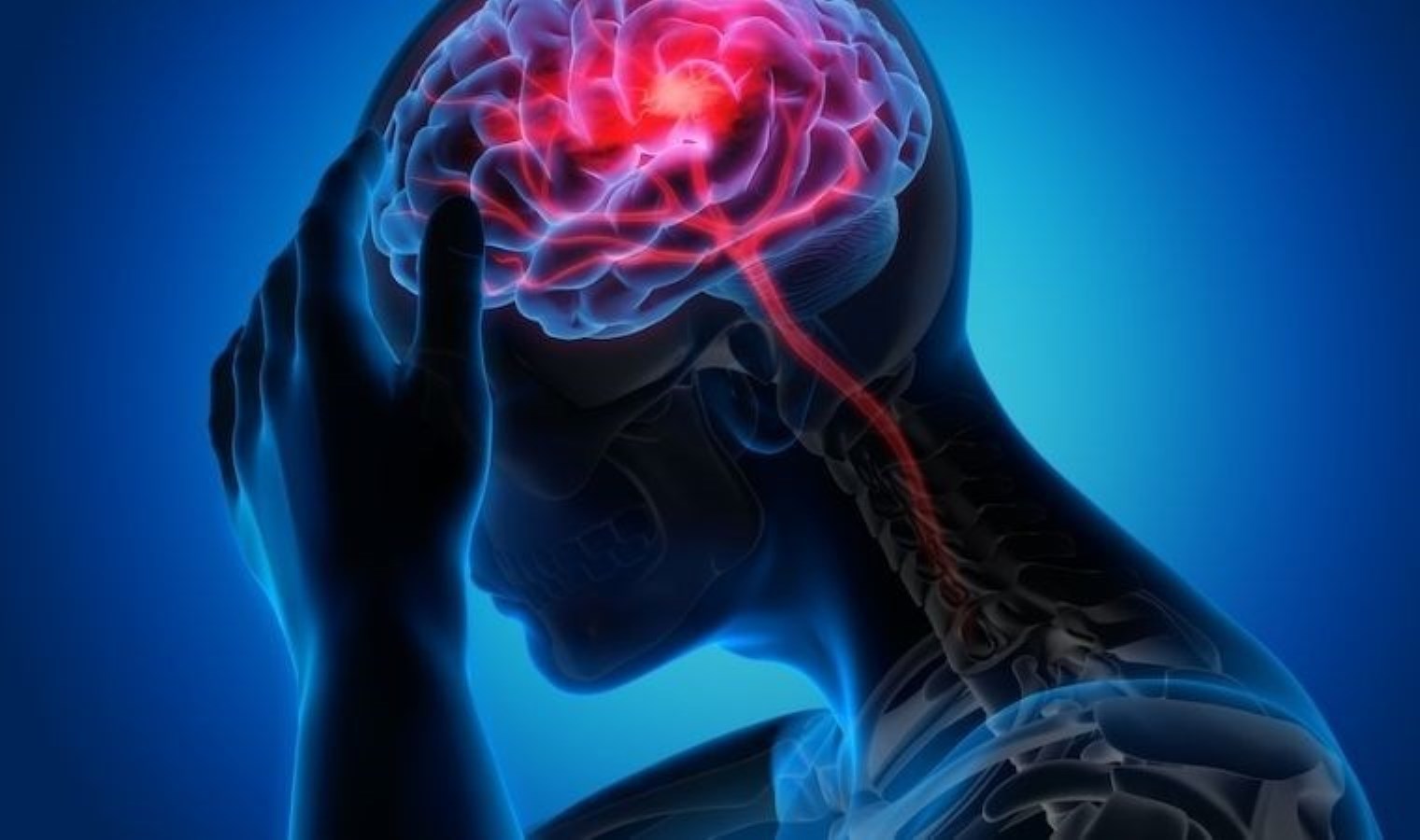 Bilim insanları, geliştirdikleri yeni yapay zeka yazılımı aracılığıyla inme geçiren