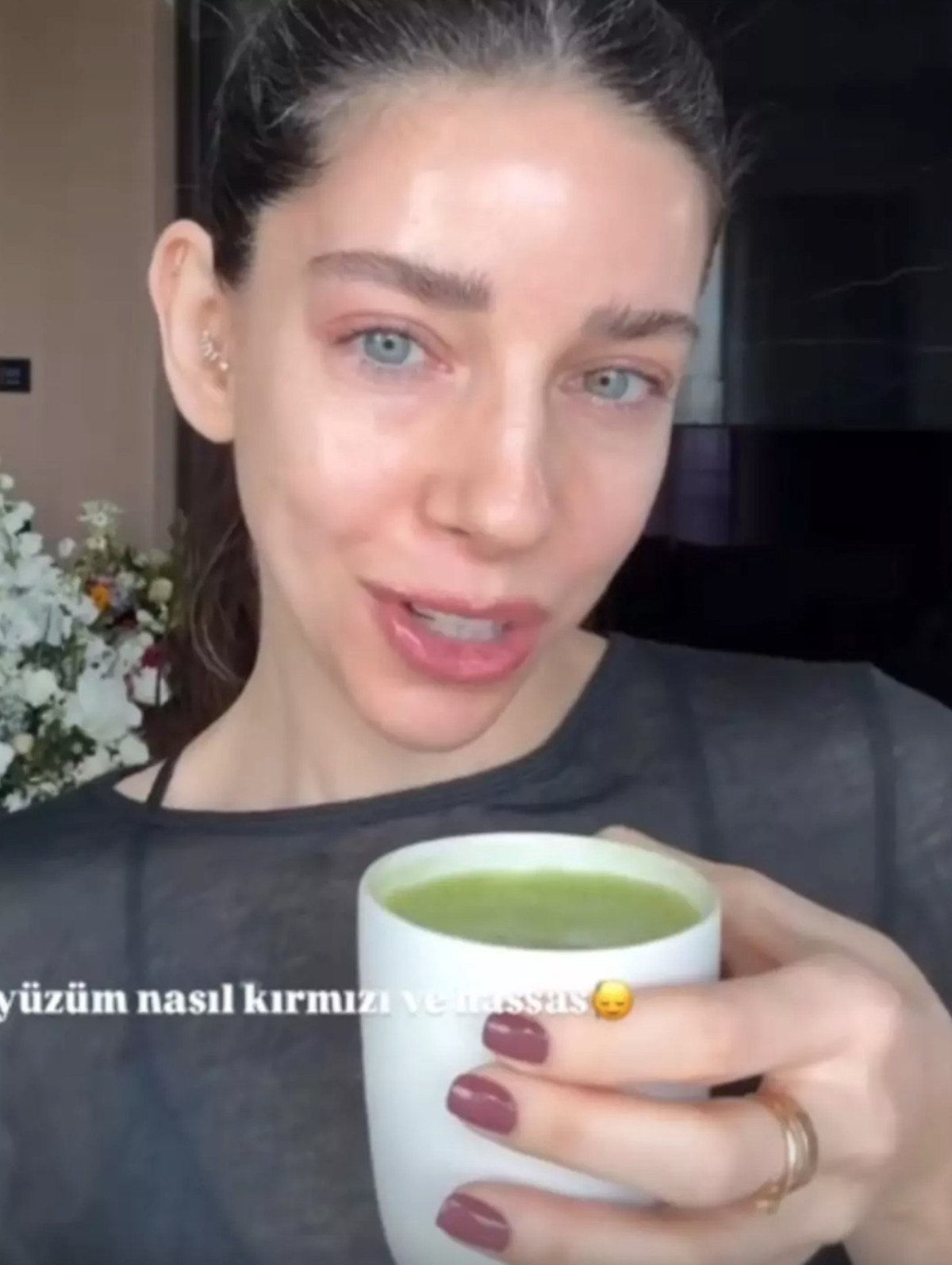 Elvin Levinler'in Sağlık Durumu ve Matcha Çayı Uyarısı