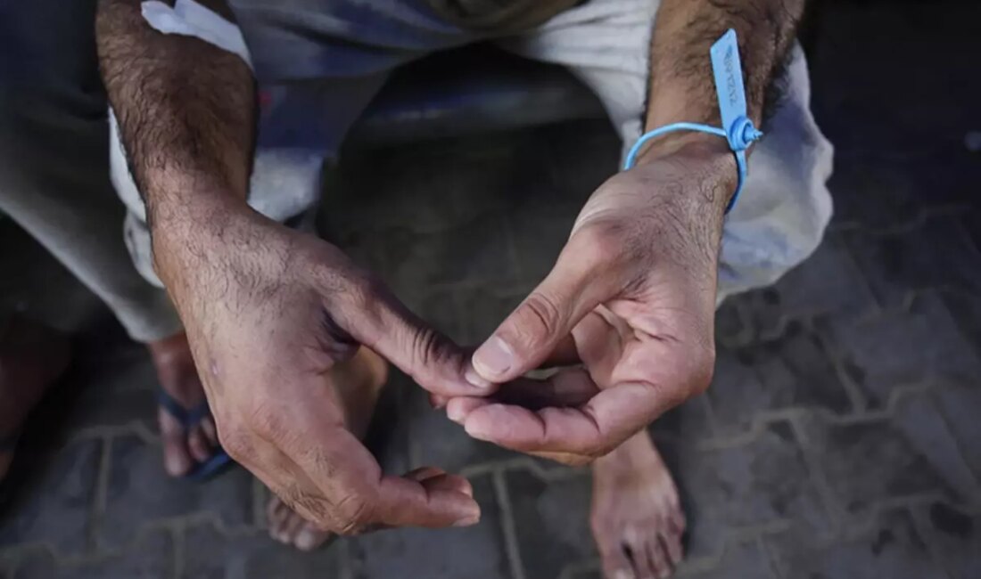 Bu içerikte, İsrail'in Gazze'deki Filistinli mahkumlara yönelik uyguladığı işkence yöntemleri