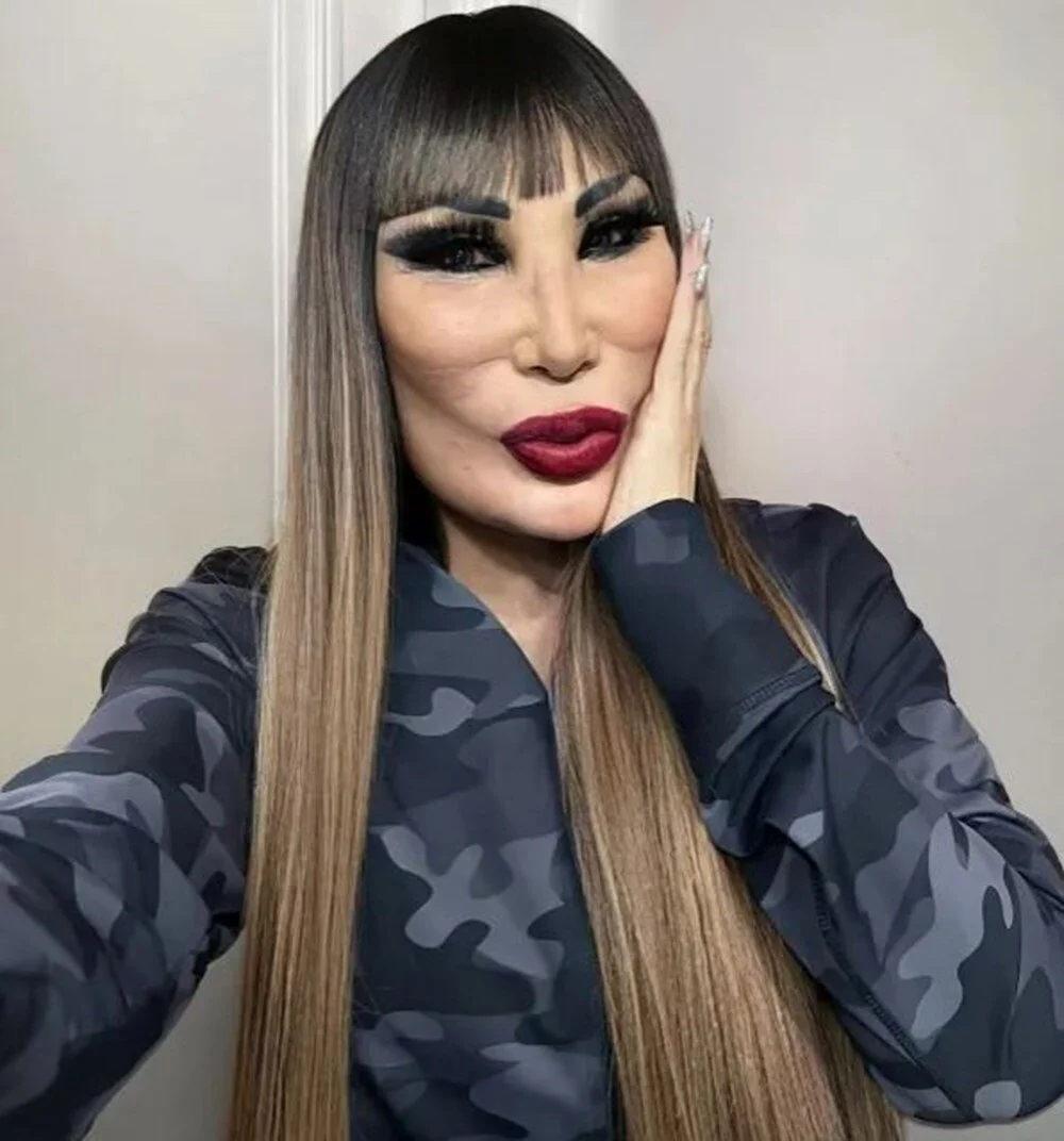 Lyn May'in Estetik Macerası