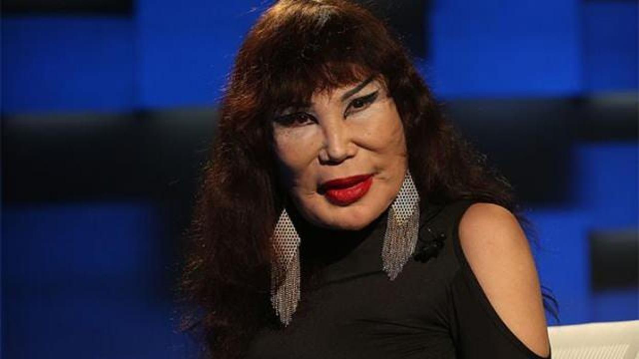 Lyn May'in estetik operasyonları ve sonuçları üzerine derinlemesine bir inceleme.