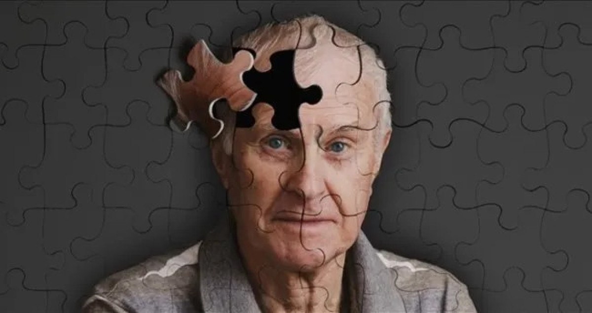 Alzheimer Nedir, Belirtileri Nelerdir?