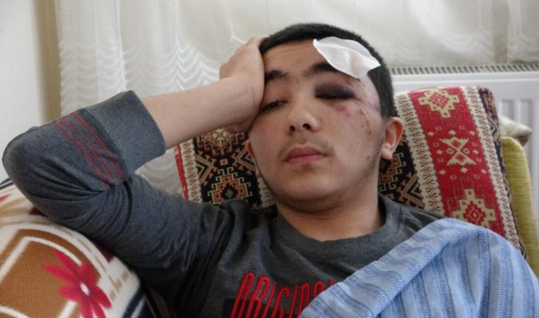 Başıboş sokak köpekleri, toplumda ciddi bir sorun haline geldi. 16