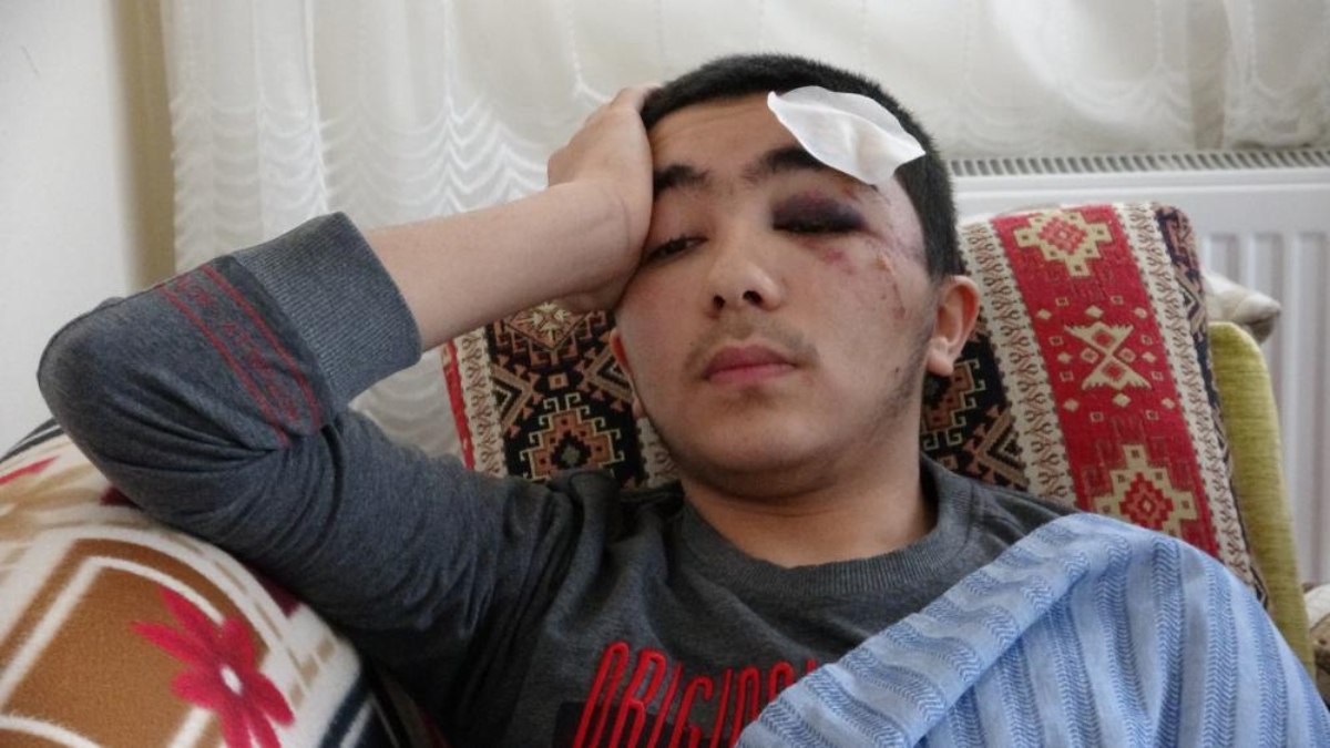 Başıboş sokak köpekleri, toplumda ciddi bir sorun haline geldi. 16
