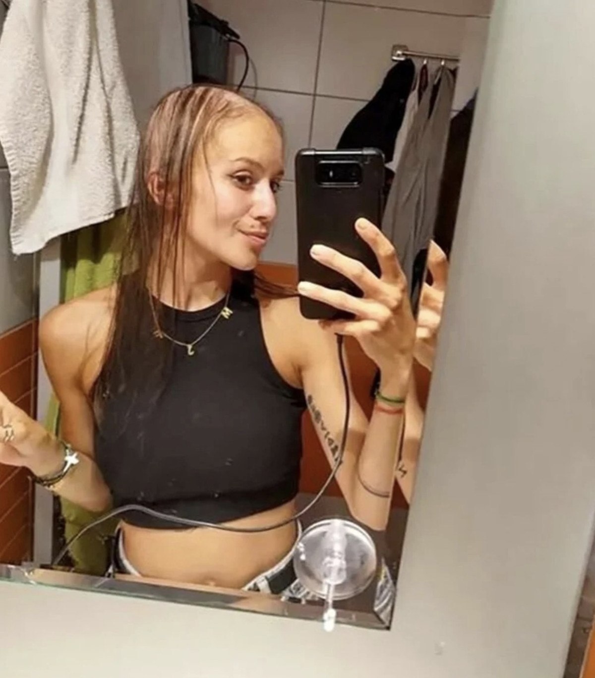 Çekya'da Estetik Ameliyat Sonrası Yaşanan Sağlık Sorunları