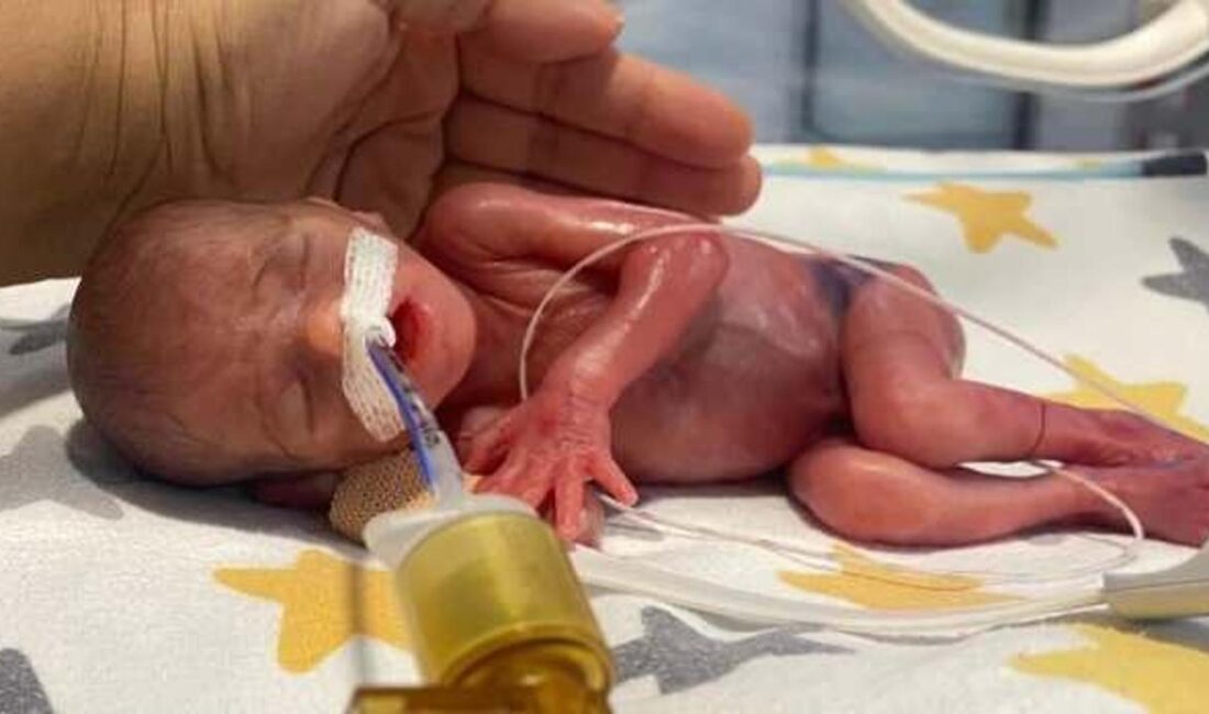 Erdemli'de dünyaya gelen prematüre bebek Hira Su'nun zorlu hayat mücadelesini