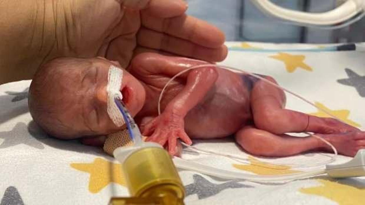 Erdemli'de dünyaya gelen prematüre bebek Hira Su'nun zorlu hayat mücadelesini