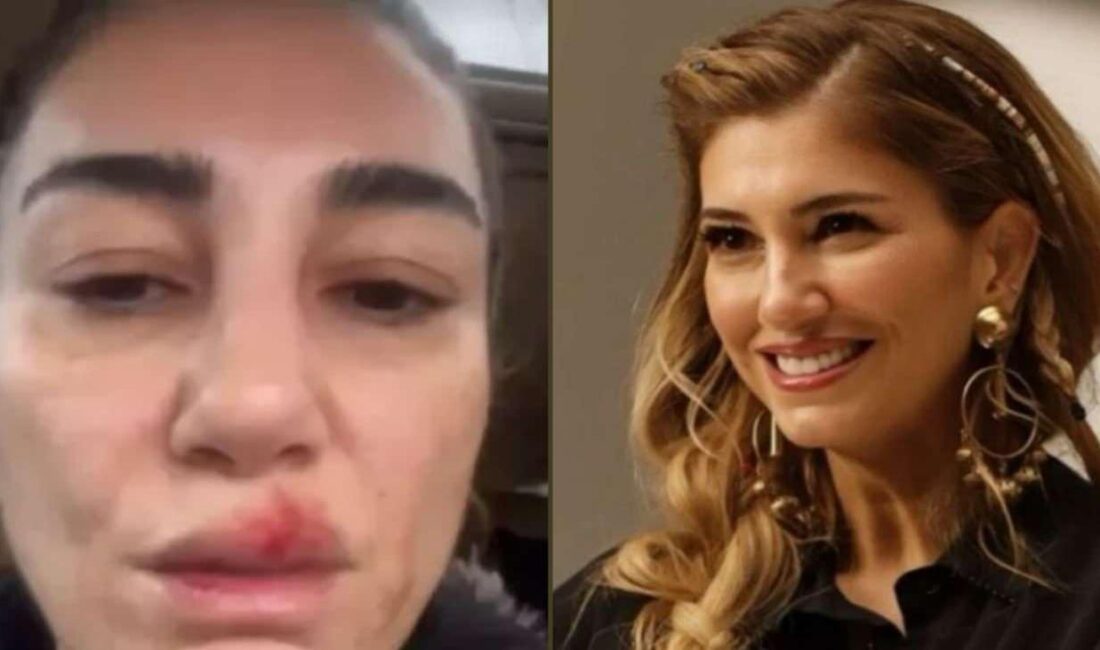 Nadide Sultan'ın buzdolabı temizlerken yaşadığı talihsiz kaza, hem komik hem