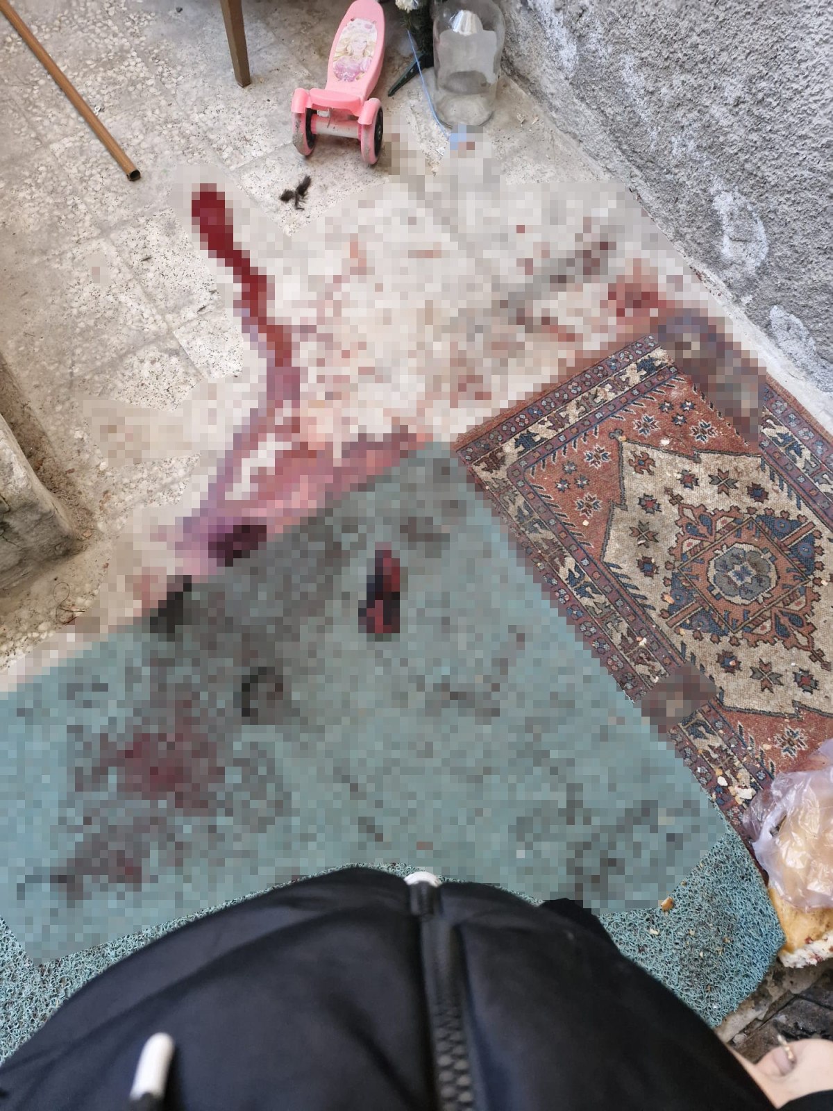 Nevşehir'de Eşinin Satırla Saldırısına Uğrayan Kadın Hayat Mücadelesi Veriyor