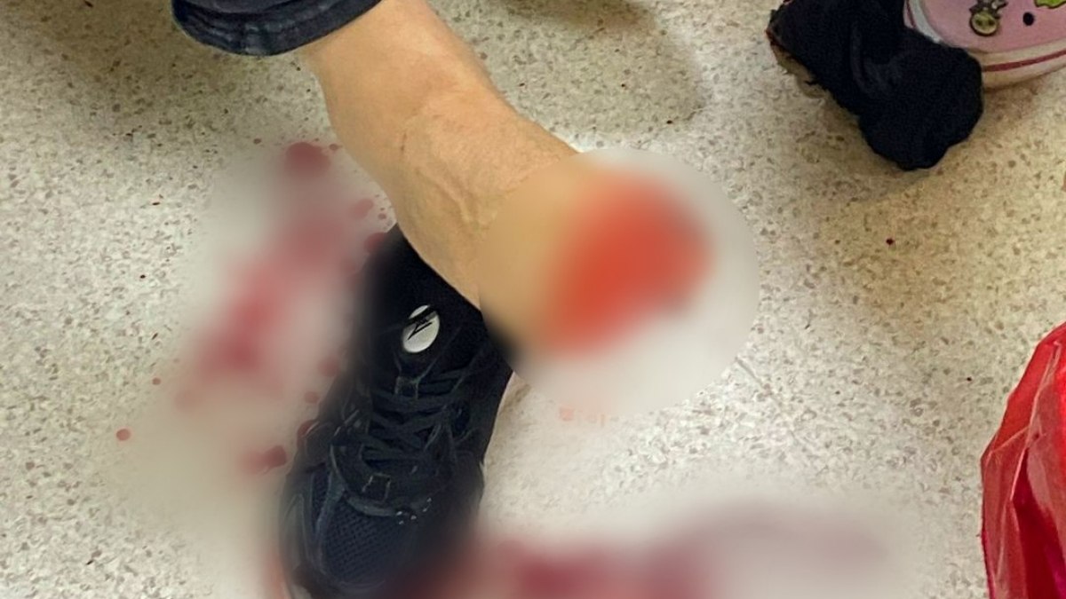 Samsun'da gerçekleştirilen uyuşturucu operasyonunda 2 polis memuru yaralandı. Olayın detayları,
