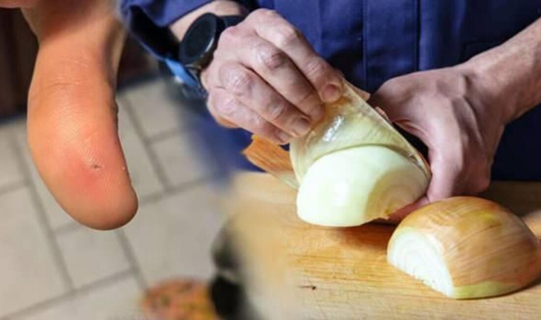 Soğan soyarken yaşanan beklenmedik bir olay, enfeksiyon ve cerrahi müdahale