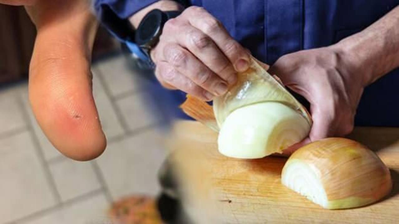 Soğan soyarken yaşanan beklenmedik bir olay, enfeksiyon ve cerrahi müdahale