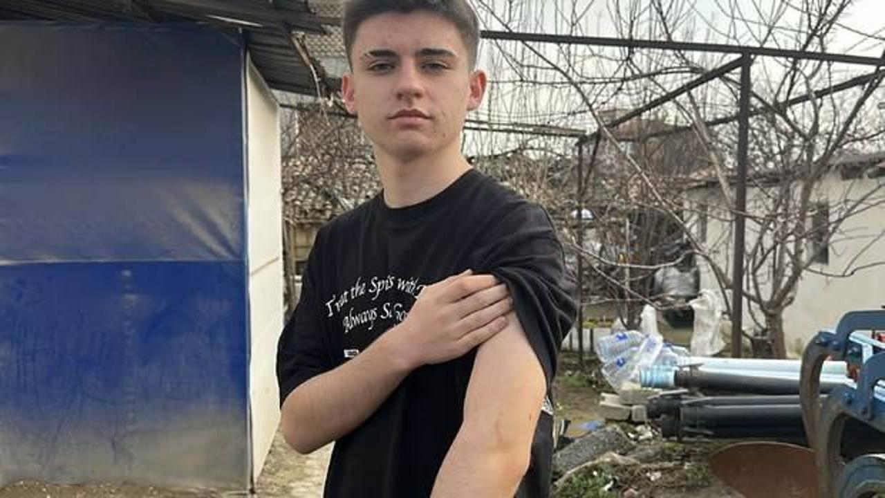 Sokak köpeği saldırısı sonucu bir öğrenci hastaneye kaldırıldı. Olayın detayları,