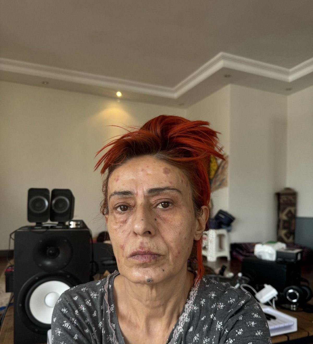 Yıldız Tilbe'den Korkutan Açıklama