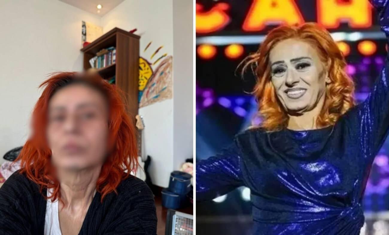Yıldız Tilbe'nin Talihsiz Saç Kazası