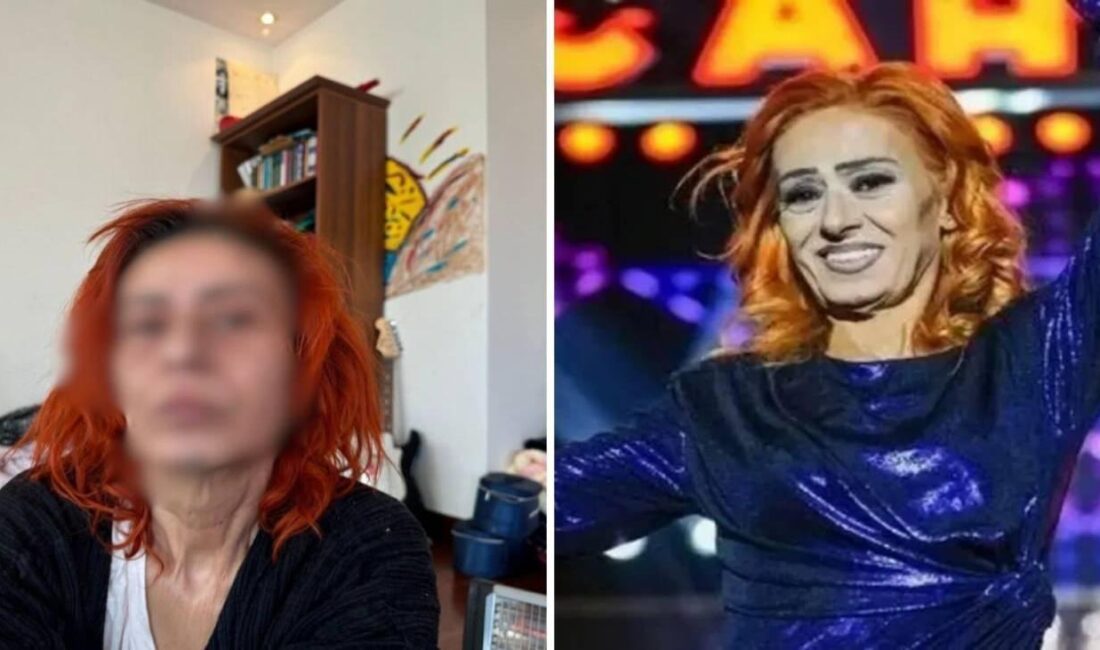 Yıldız Tilbe'nin saç boyama kazası sonrası yaşadığı yanıklar ve tedavi