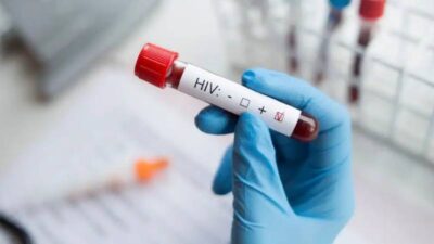 Türkiye’de HIV Alarmı: Vakaların Yarısı Teşhis Alamıyor, “Sessiz Pandemi” Uyarısı HIV vakalarının 10 yılda 12 kat arttığı Türkiye’de uzmanlar, damgalanma